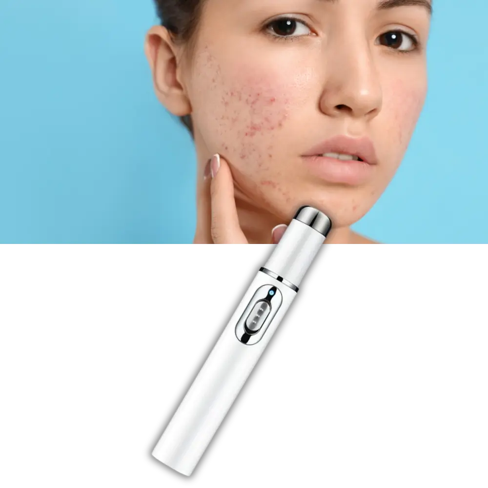 Blue Light Therapy Pen - Zoozto