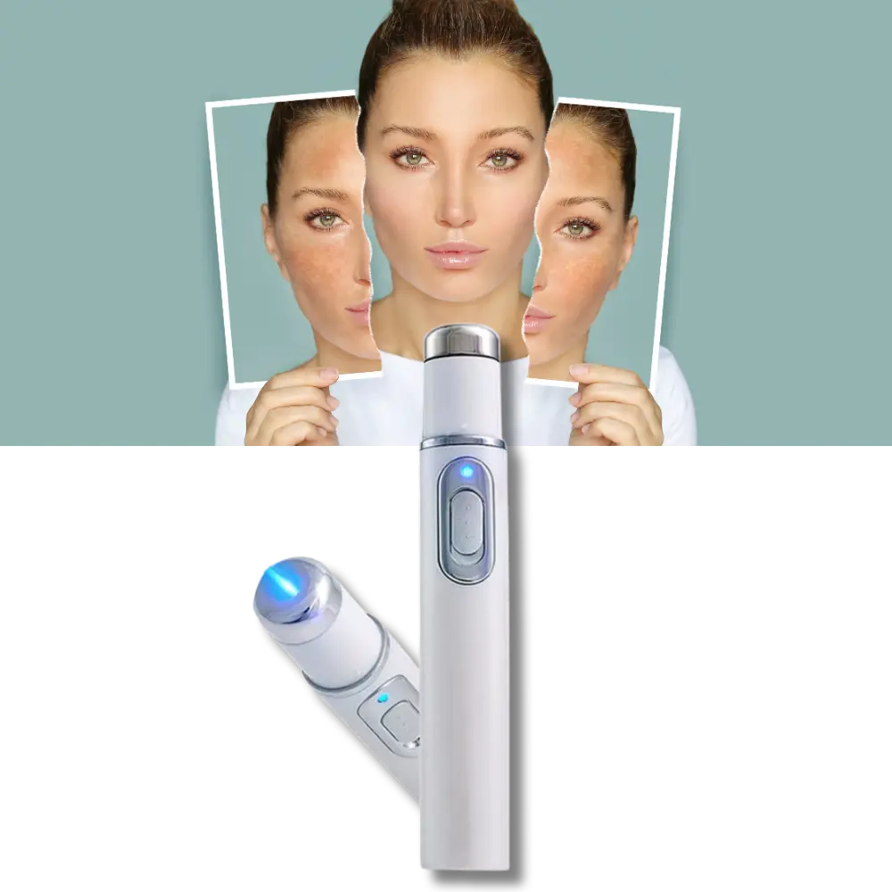 Dark Spot Remover Blue Laser Pen - Zoozto