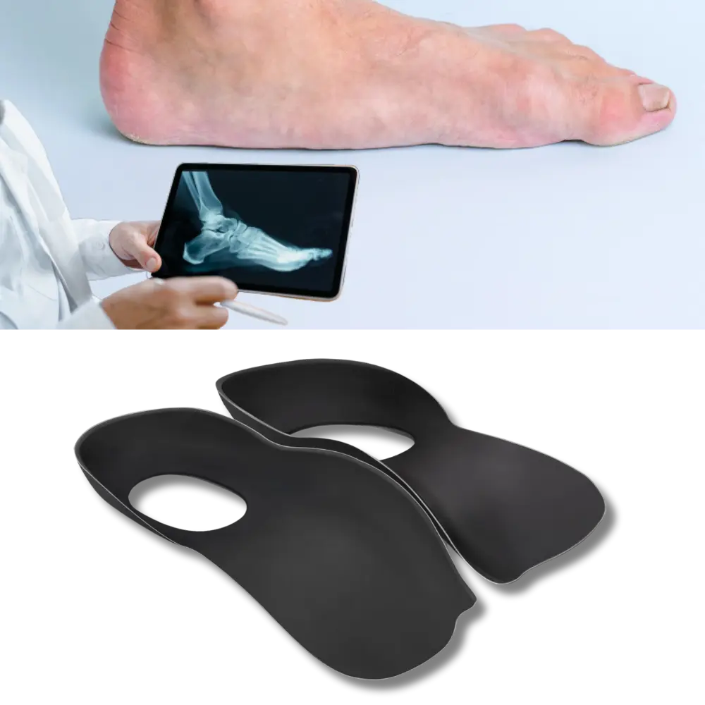 Orthopedic Insoles for Flat Feet - Zoozto