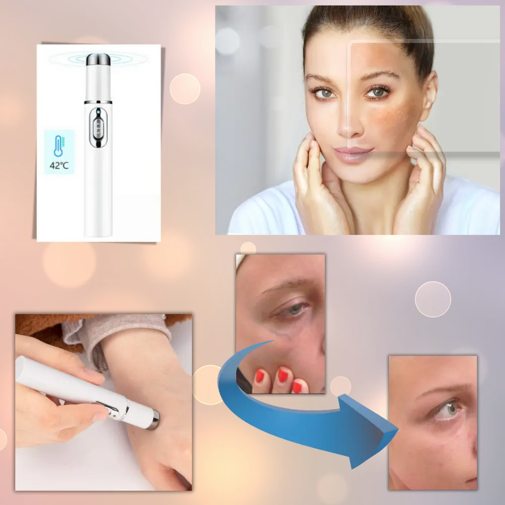 Blue Light Therapy Pen - Zoozto