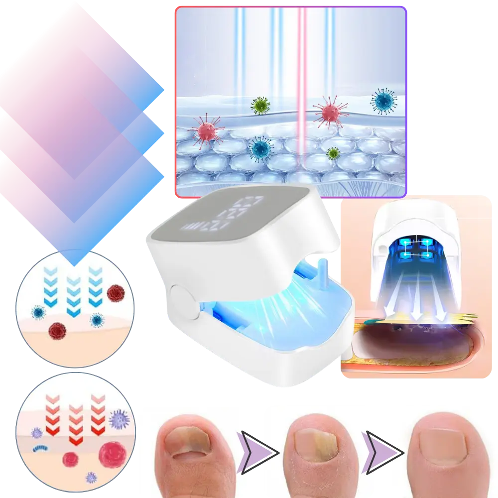 Laser Toenail Fungus Treatment Device - Zoozto