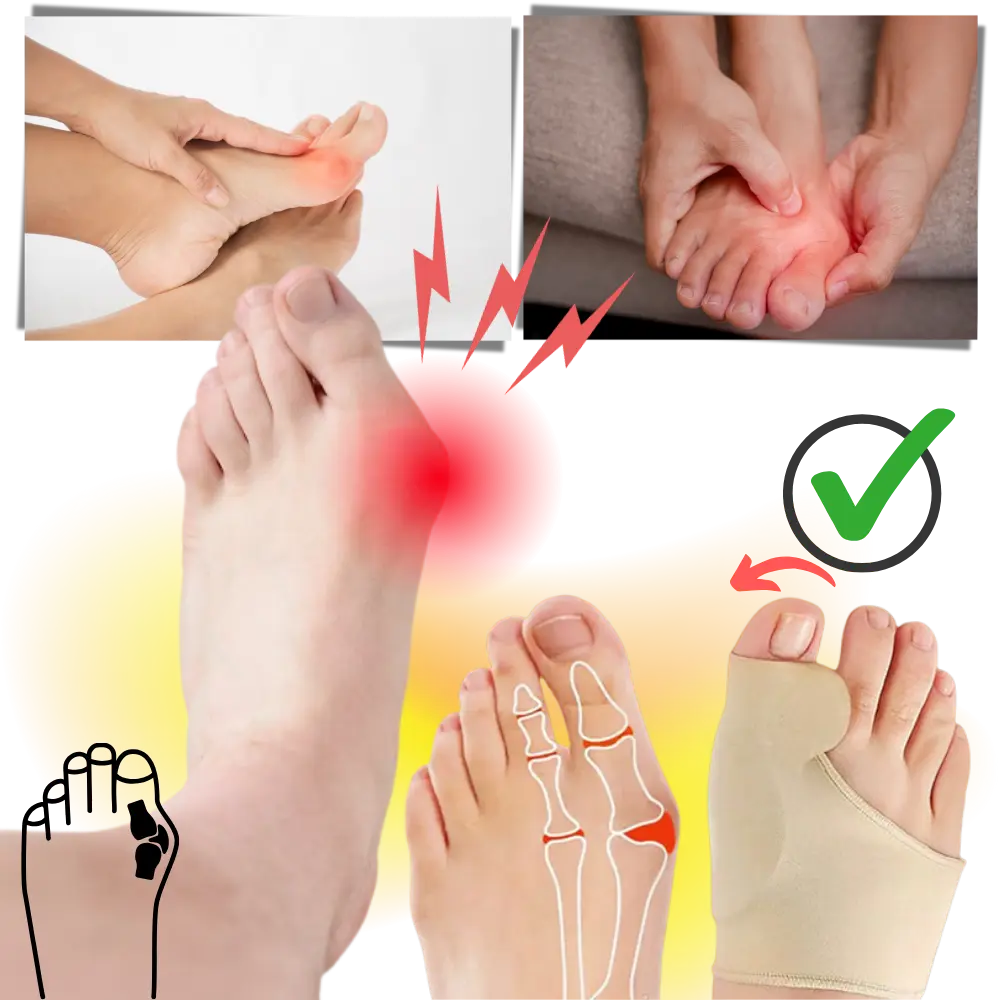 Silicone Bunion Corrector Toe Separator - Zoozto