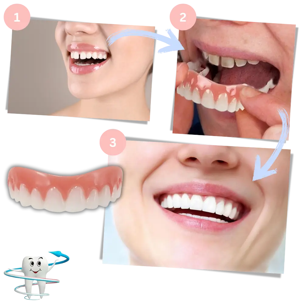 Snap-On Veneer Teeth - Zoozto