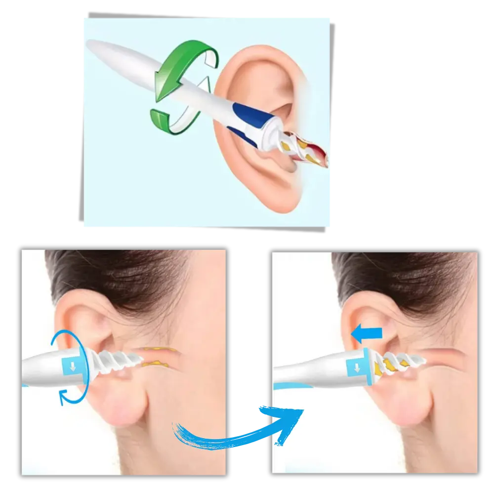Spiral Ear Wax Remover - Zoozto